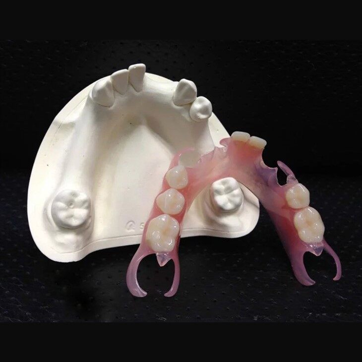 Dental Bilateral Partial Valplast Denture suppliers