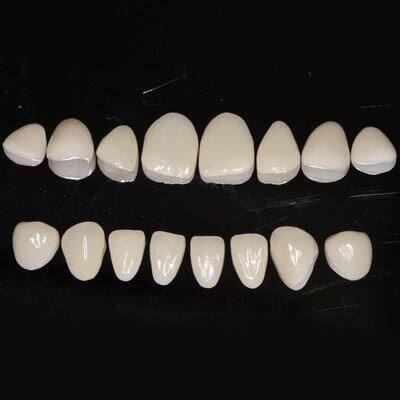 Dental Full Arch Porcelain Emax Veneer suppliers