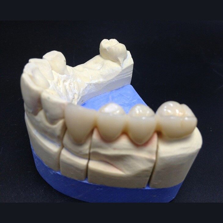 Dental Full Contour Zirconia Crown suppliers