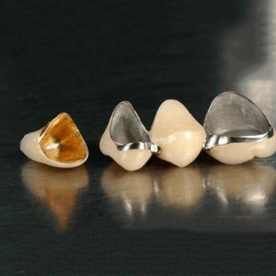 Dental Porcelain Fused To Semi Precious Crown suppliers