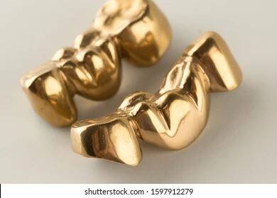 Dental Semi Precious Yellow Gold Crown suppliers