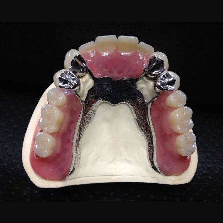 Dental Telescope Precision Attachment With Denture suppliers