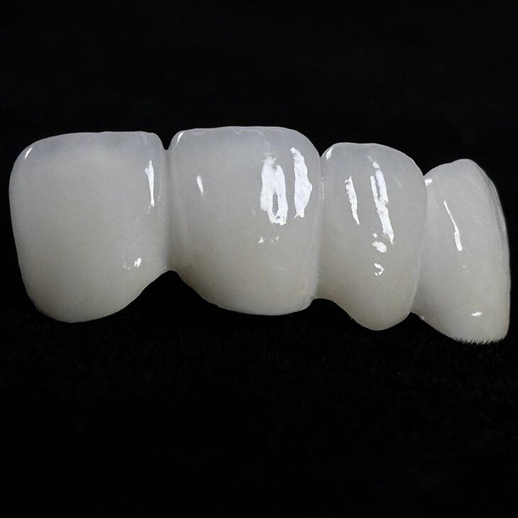 Dental Transparent Multilayer Colored Zirconia Crown best