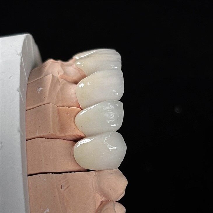 Dental Transparent Multilayer Colored Zirconia Crown factory