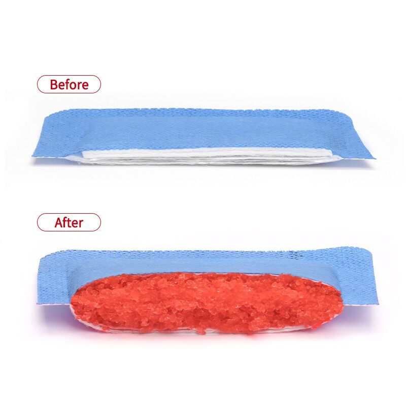 Superabsorbent Dressing