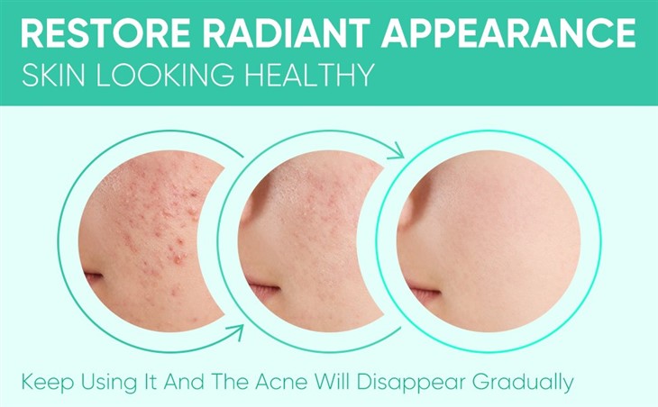 35% Glycolic Acid Facial Peel Pads
