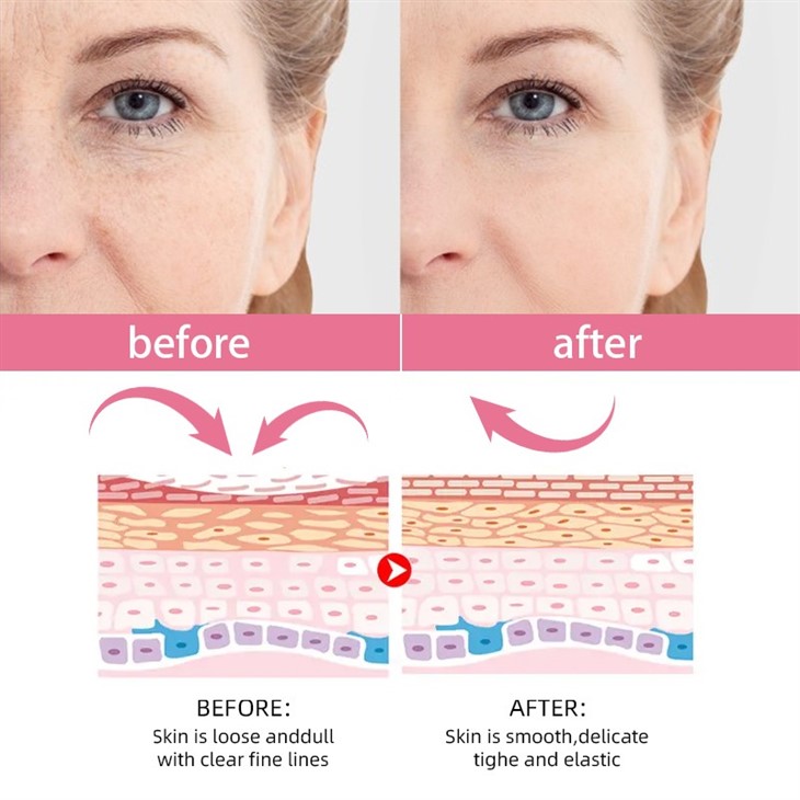 5 in 1 Serum