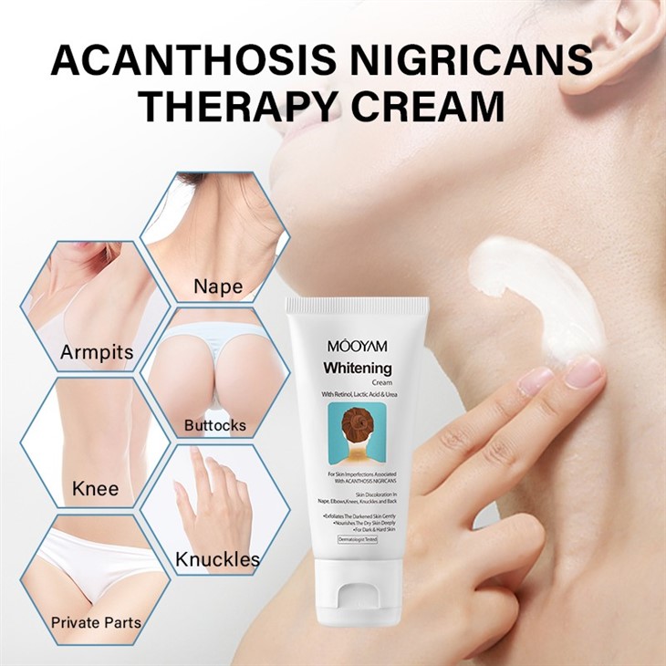 Acanthosis Nigricans Therapy Cream