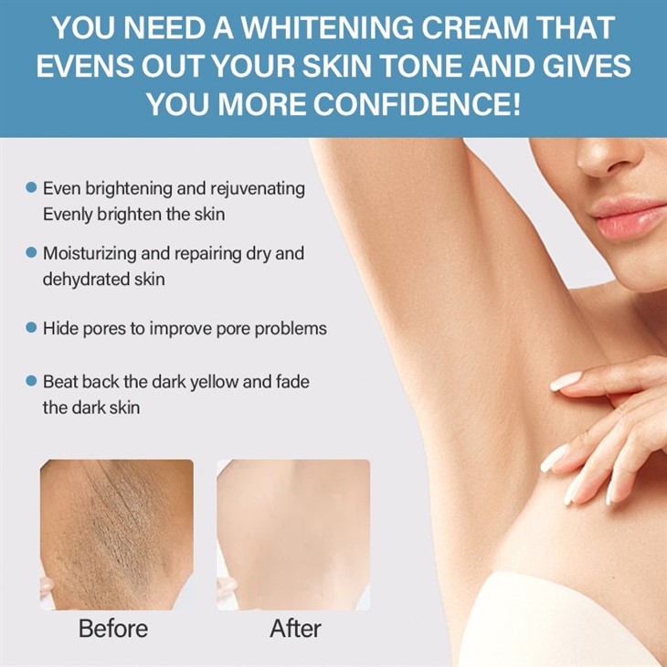 Acanthosis Nigricans Therapy Cream