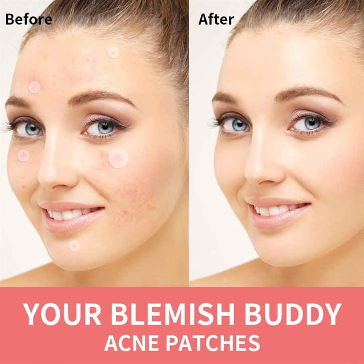 Acne Patch
