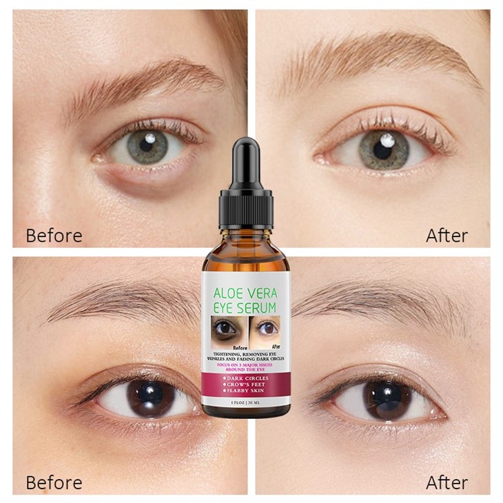 Aloe Vera Eye Serum