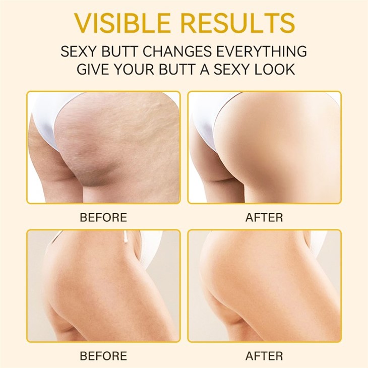 Buttock Enlargement Cream