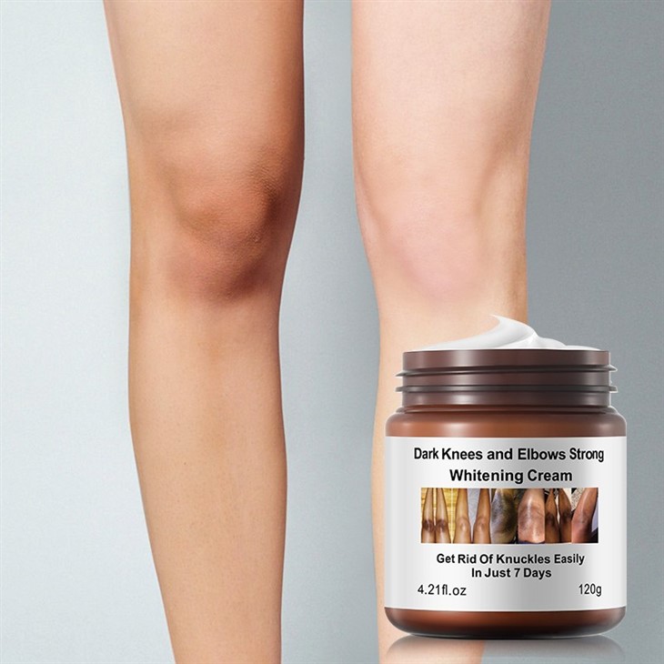 Dark Knees And Elbows Strong Whitening Cream