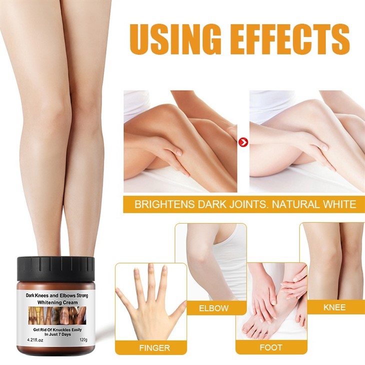 Dark Knees And Elbows Strong Whitening Cream