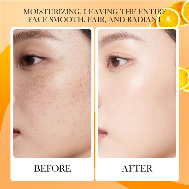 ERSU Vitamin C Whitening Skincare Set suppliers