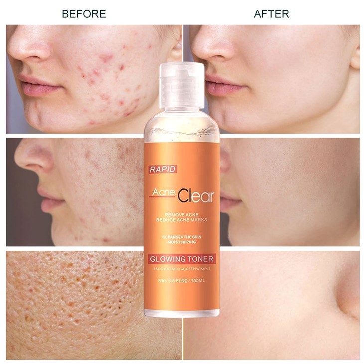 Glowing Toner