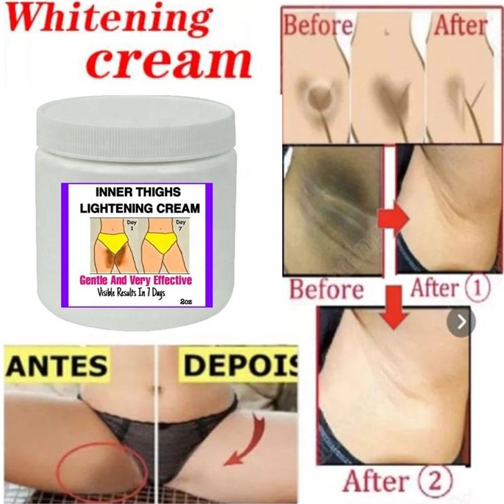 Inner Thighs Lightening Cream