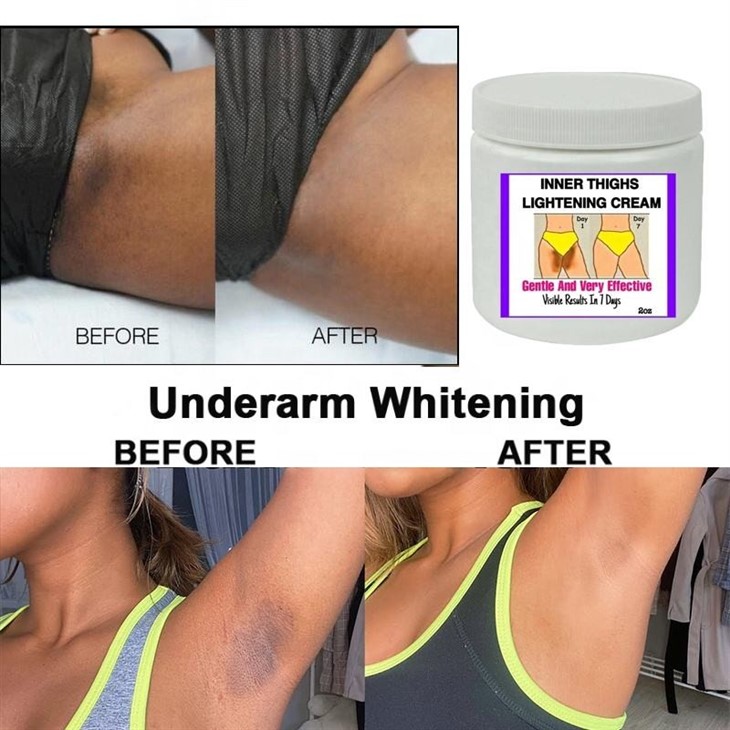 Inner Thighs Lightening Cream