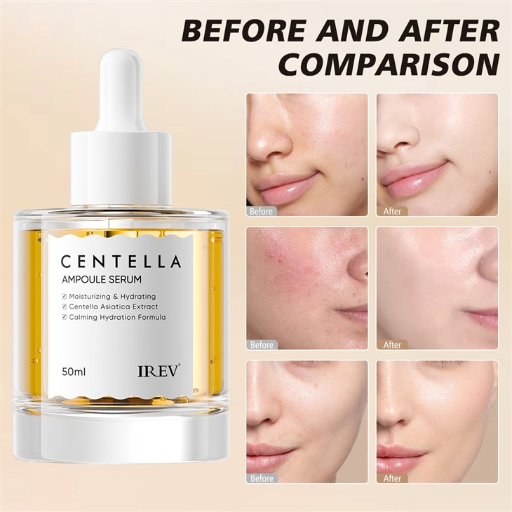 IREV Centella Ampoule Serum best