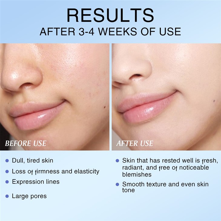 IREV Hyaluronic Acid High Moisturizing & Hydrating Pads high quality