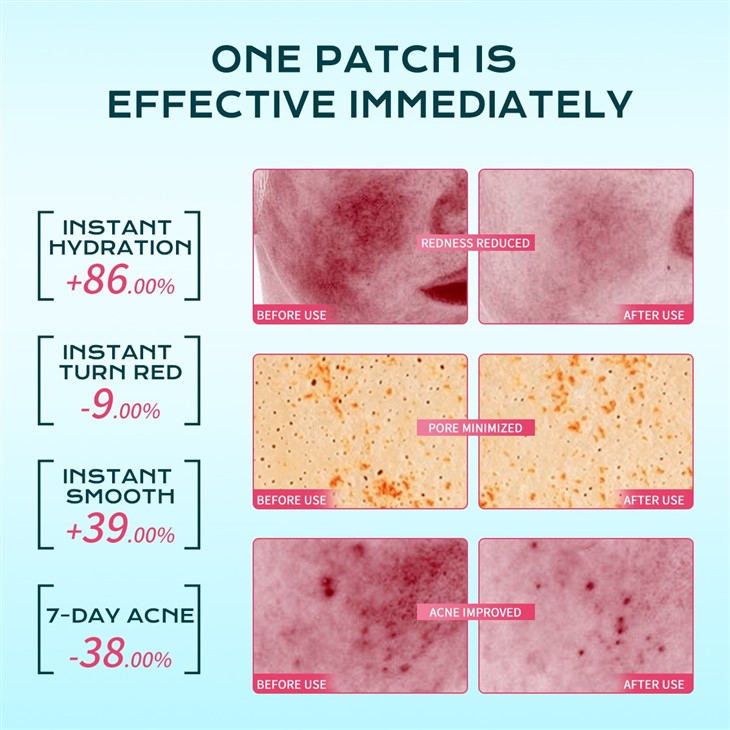 IREV Salicylic Acid Refreshing Acne-Clearing Pads suppliers
