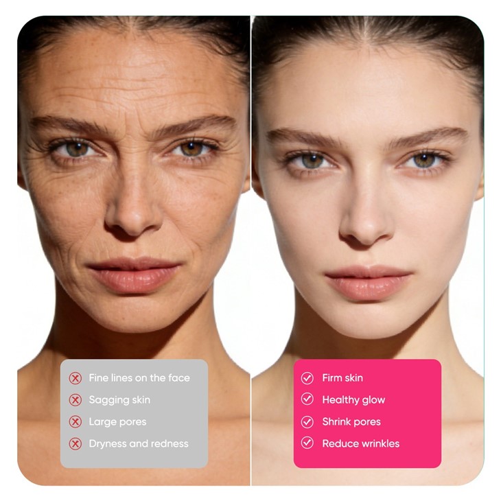 IREV Salmon DNA Collagen Hydrating Pads factory