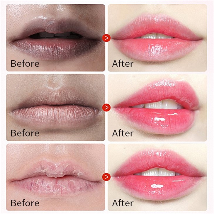 Lip Mask
