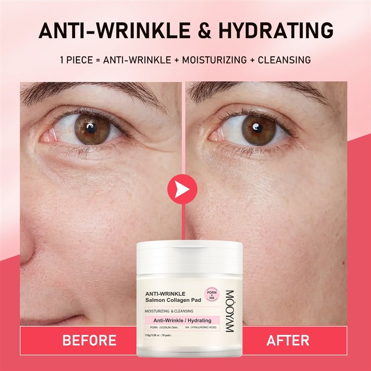 MOOYAM Anti-Wrinkle Salmon Collagen Pads best