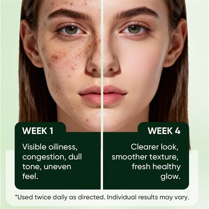 MOOYAM Houttuyni Cordata Pore Deep Cleansing Foam high quality