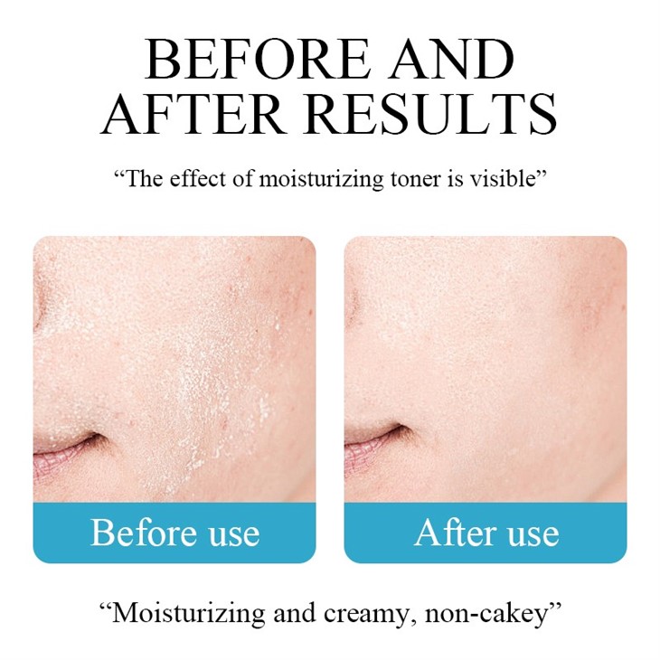 MOOYAM Hyaluronic Acid Facial Toner