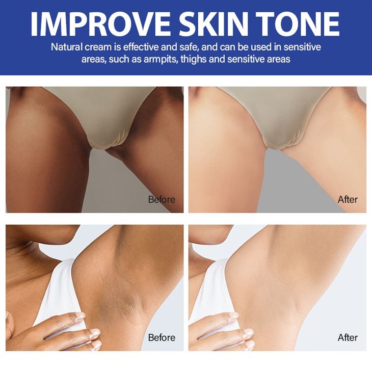 Mooyam Intense Whitening Cream