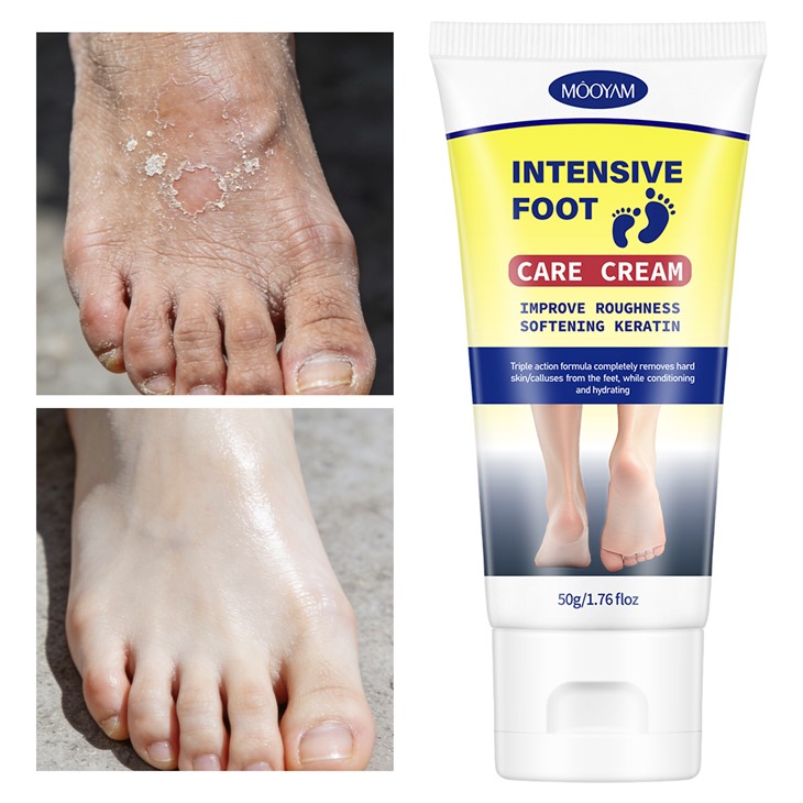 MOOYAM Intensive Foot Care Cream