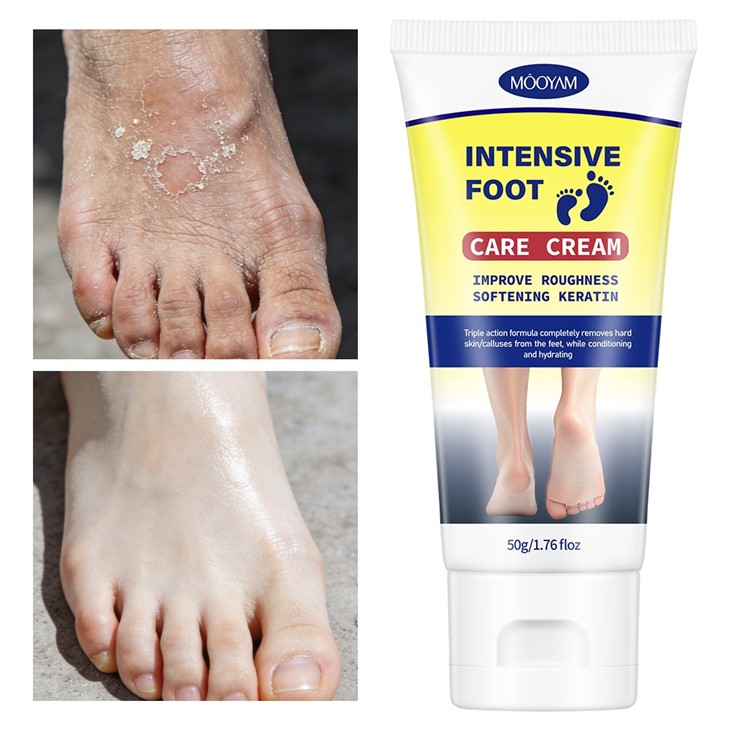 MOOYAM Intensive Foot Care Cream high quality