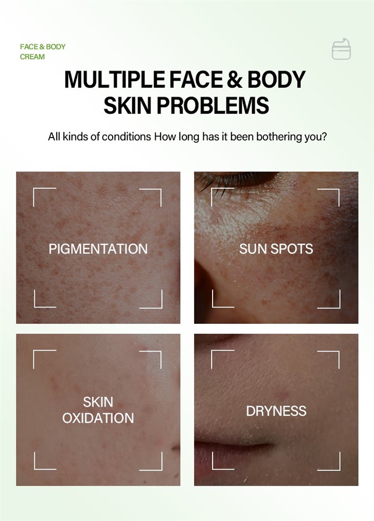 MOOYAM Kojic Acid Brightening Cream