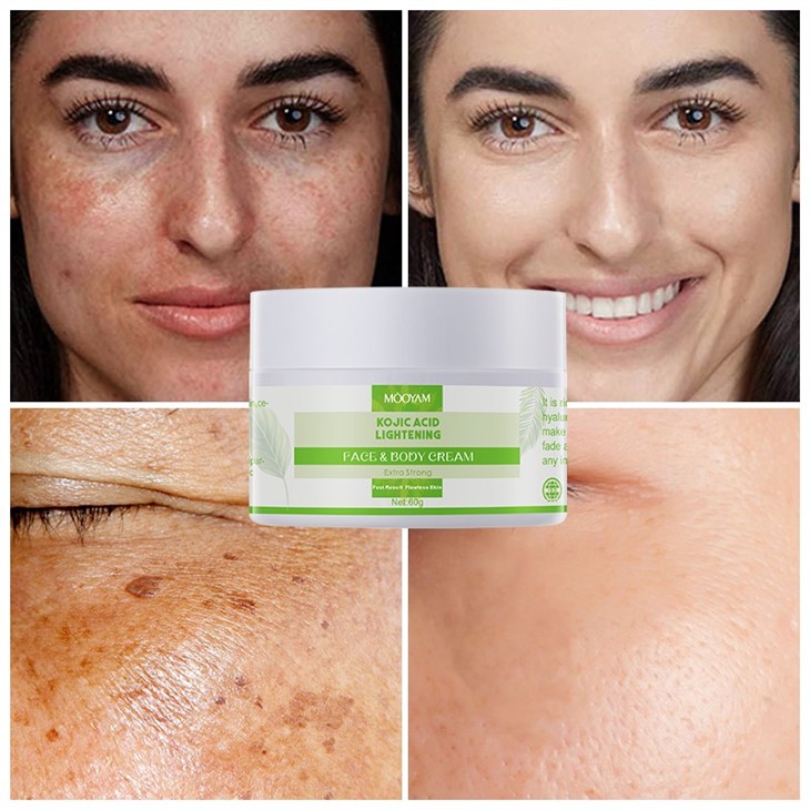 MOOYAM Kojic Acid Brightening Cream