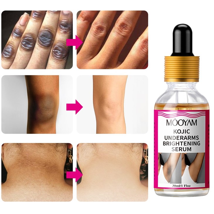 MOOYAM Kojic Underarms Brightening Serum
