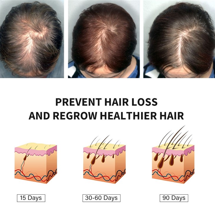 MOOYAM Rosemary Mint Scalp & Hair Strengthening Oil