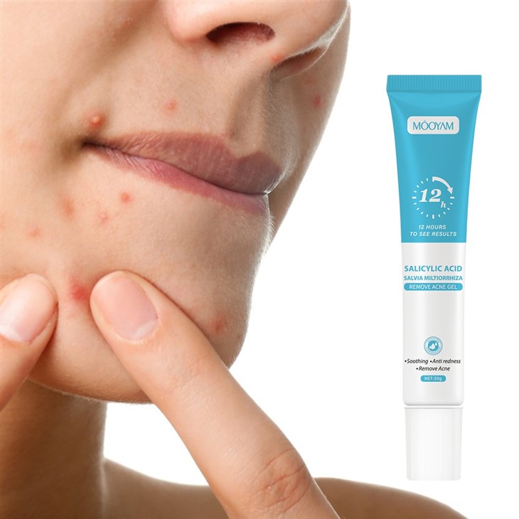 Mooyam Salicylic Acid Remove Acne Gel