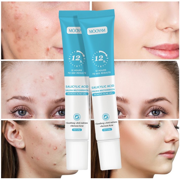 Mooyam Salicylic Acid Remove Acne Gel