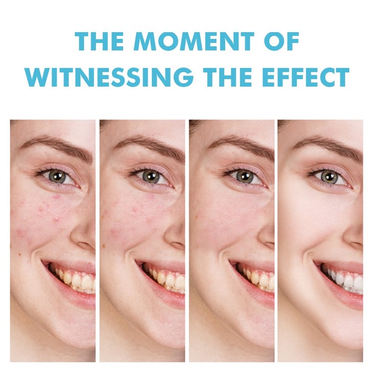 Mooyam Salicylic Acid Remove Acne Gel