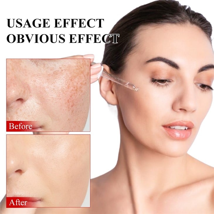 MOOYAM Whitening And Repair Serum