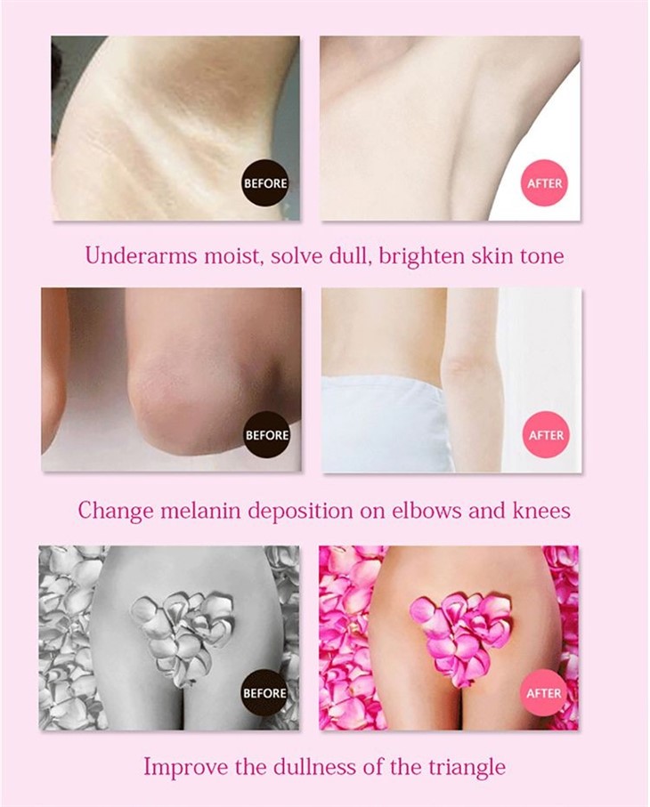 Natural Underarm Whitening Cream