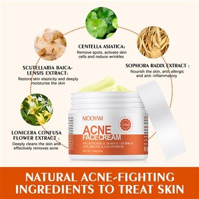 Acne Removal Face Cream