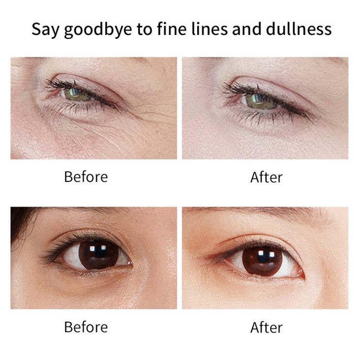 Retinol Eye Stick