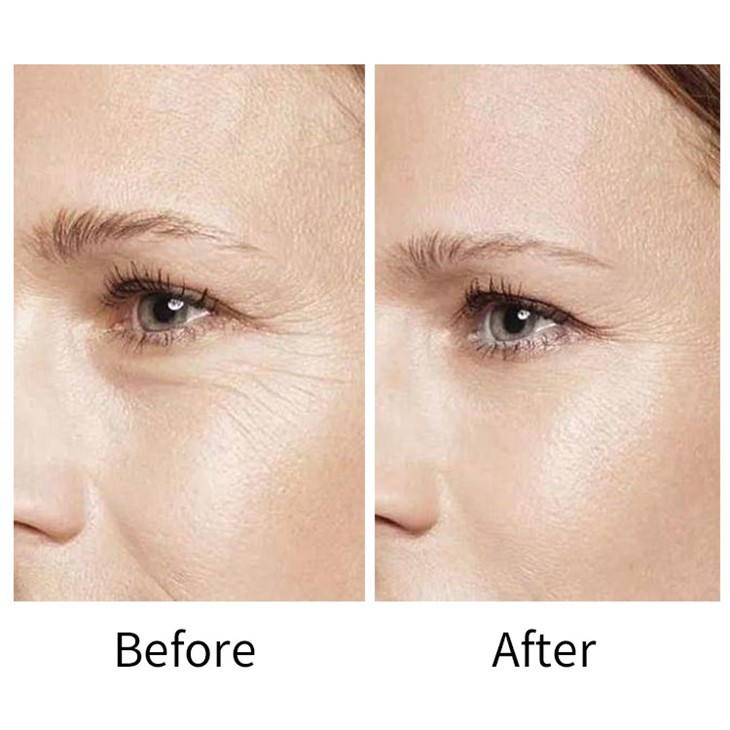Retinol Eye Stick