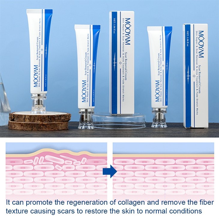 Scar Remove Cream