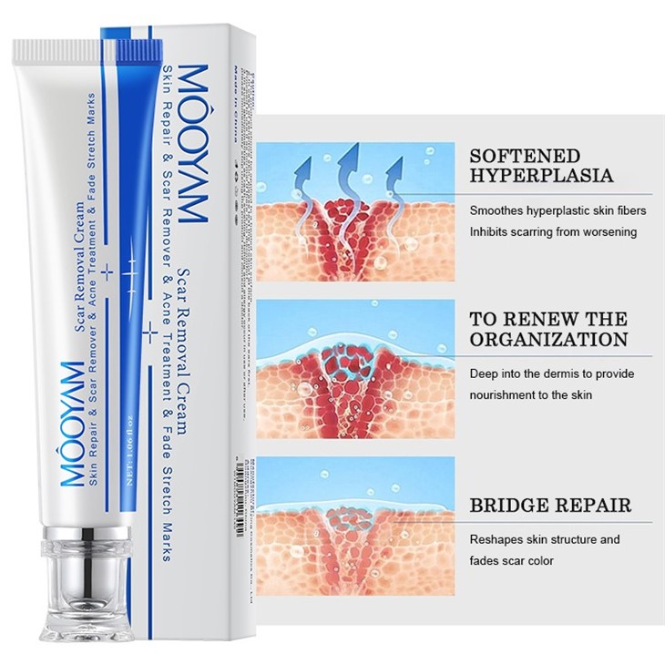 Scar Remove Cream