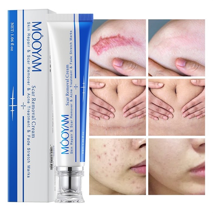 Scar Remove Cream