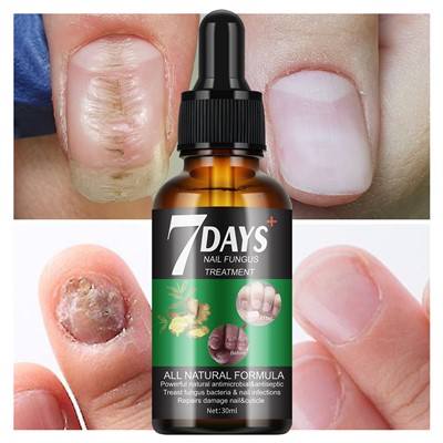 7 Days Nail Fungus Treatment Serum