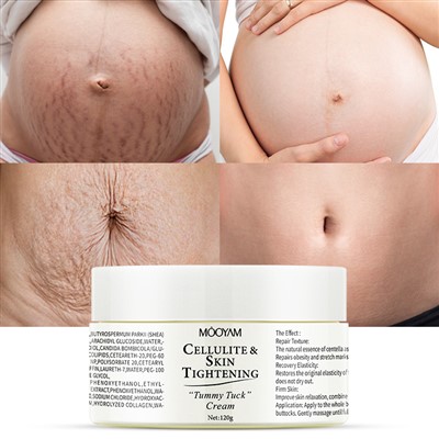 Celluilte & hudstramning Stretch Mark Cream